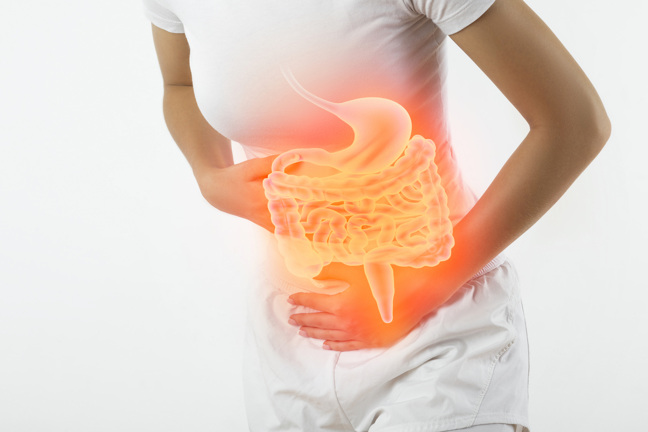 Inflammatory Bowel Disease Associated with Arthritis