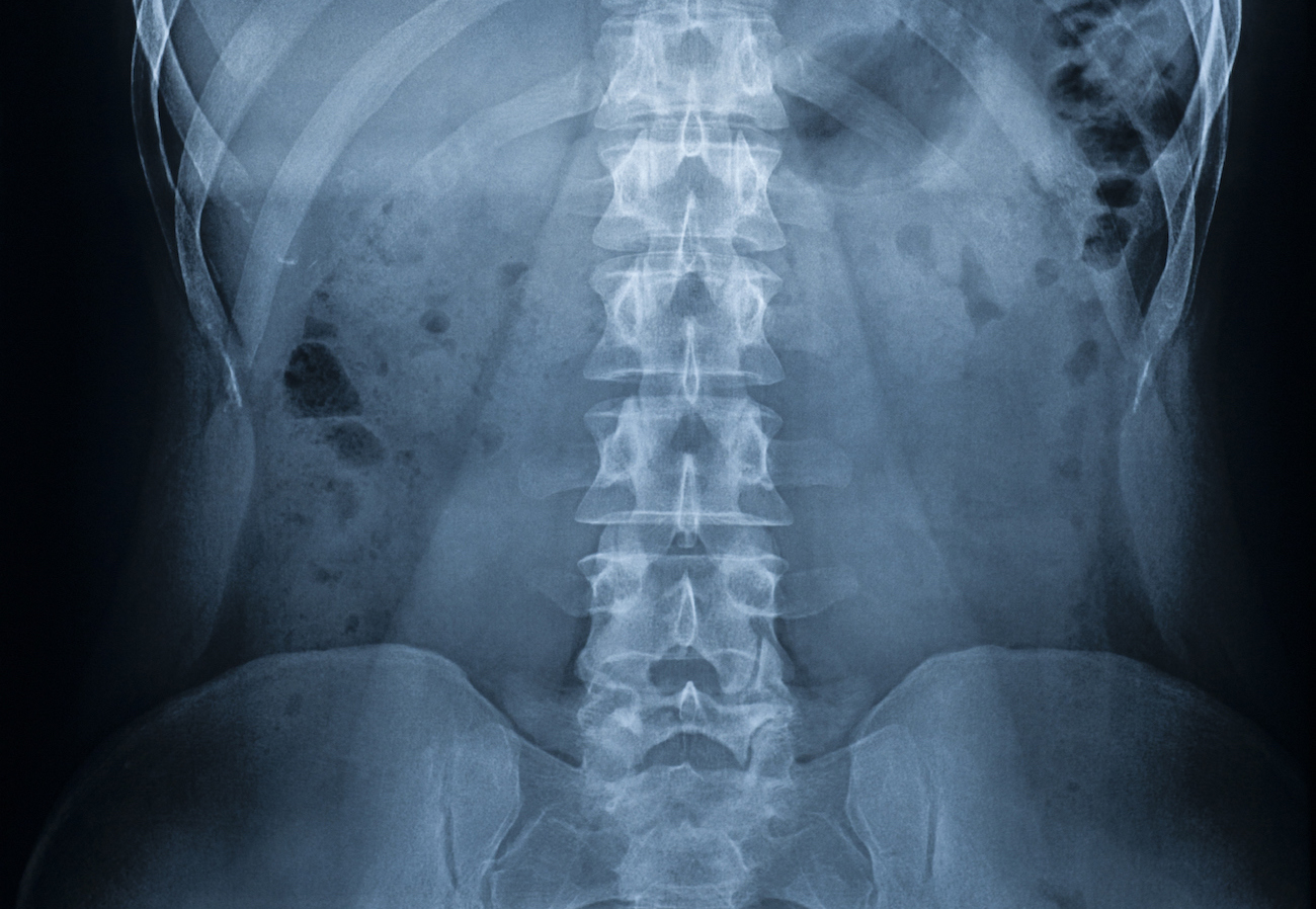 X-ray of a man’s body - spine, pelvic bones, ribs, internal organs